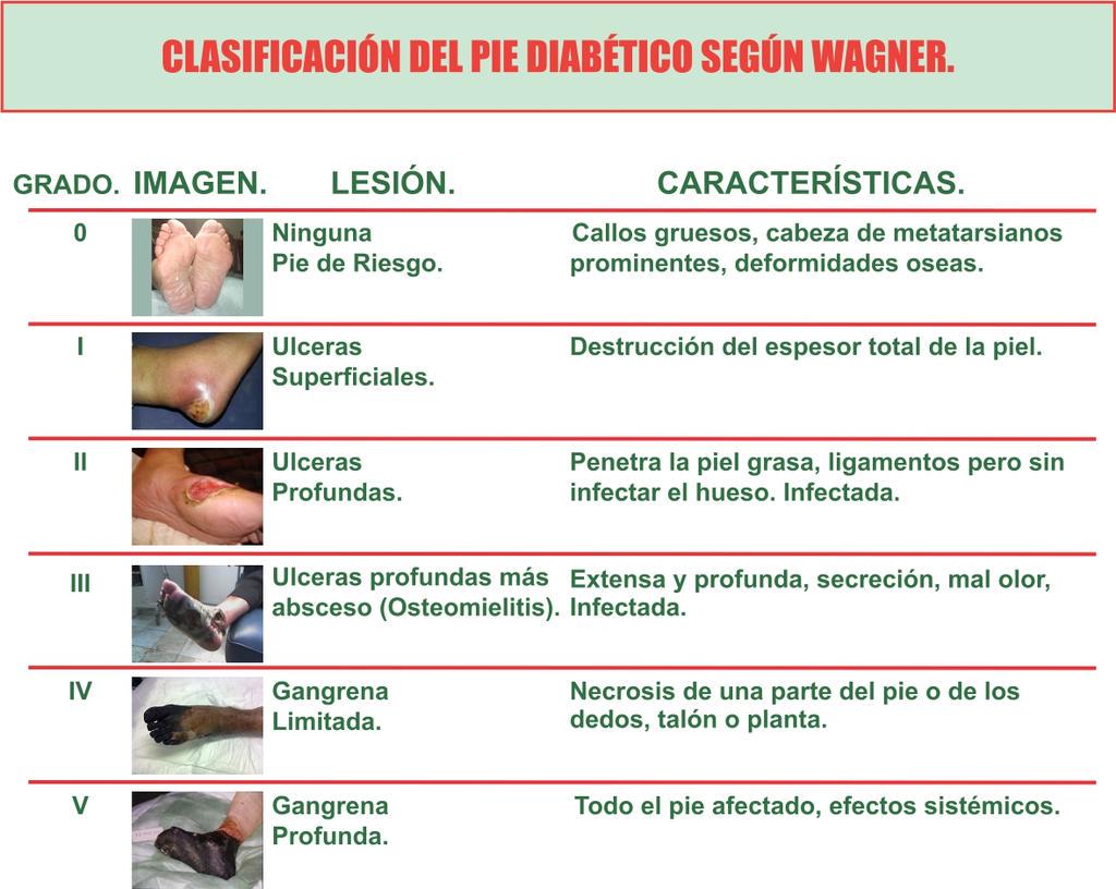 Que puede desayunar un diabetico Que puede desayunar un diabetico