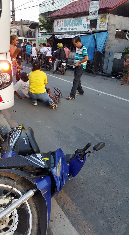 staceygeronimo's tweet photo. @TVPatrol Lalaki nasagasaan ng motor putol ang paa, photo credits to Peachy Santos Demen, FB account of Teresa Rizal http://t.co/GQVqwVRN5U