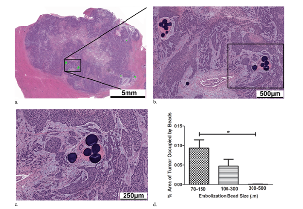 Quantifying tumor coverage and hypoxia with different size microspheres | #iRad ow.ly/RggEb