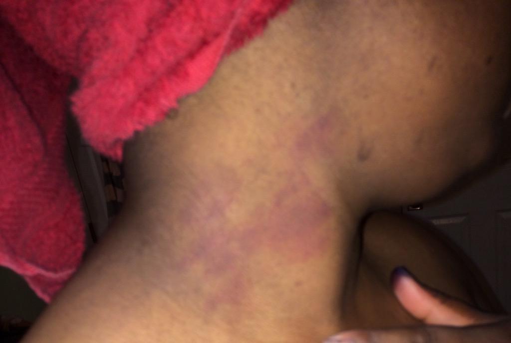 MelissaFiasco's tweet image. #SíPapí