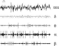 lordrochester's tweet photo. Donald Trump's signature looks like a seizure EEG. http://t.co/so2tu5c5LR