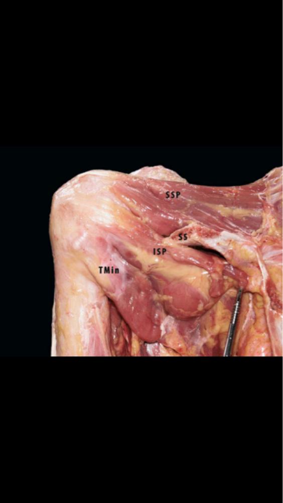 Lovely dissection of the rotator cuff. Learn a host of ways to test &amp; treat it on our manual therapy courses. <a href="/UK_STA/">Sports Therapy Association</a>