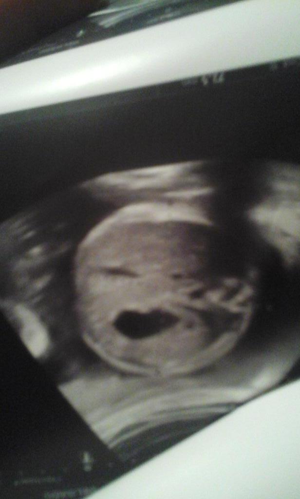 gonzalezandre18's tweet photo. @parentelauy @igalvar71 @manudasil @MonteCarloTV mi amada aymara belen mirando parentela con 29semanas http://t.co/kZK8DSs4hU