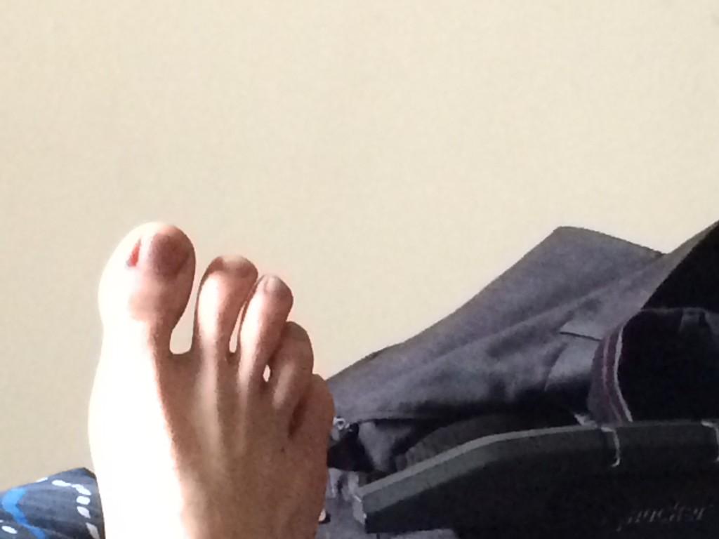 mannersmyth's tweet photo. @AngeP37 @RobbieProuse @stephensmyth20 normal feet over here http://t.co/Rm7l0eGJ0H