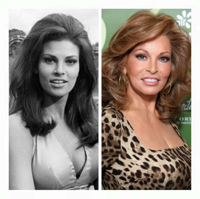   Raquel Welch turns 75 years young today! Happy Birthday, Raquel! 
What happened to her nose, points down