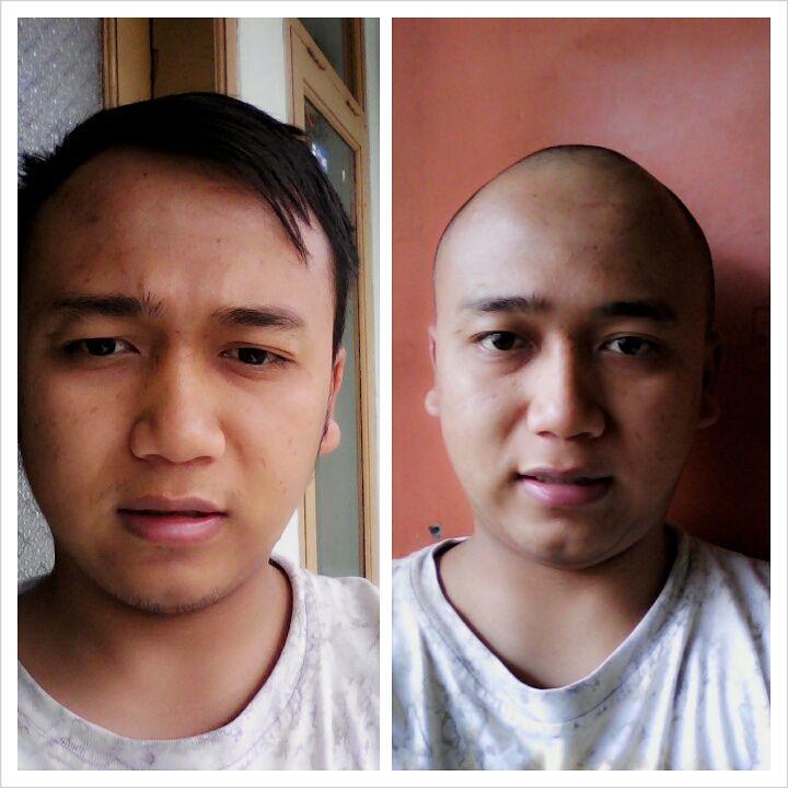 andika_lf's tweet photo. Peduli anak2 penderita kanker, kita sama2 botak. @shaveforhope #SFH2015 #ShaveForHope #Kanker #Botakin http://t.co/sOBHD0CtV5