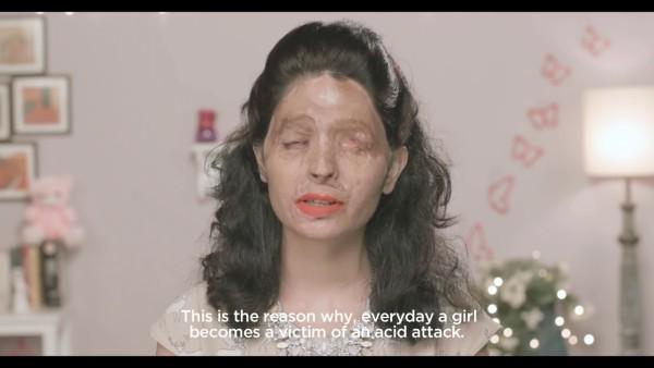 stompsingapore's tweet photo. 18-year-old acid attack victim sends heartfelt message through makeup tutorial video  http://t.co/YWBaOkLLXr http://t.co/GH2hdbfvmI