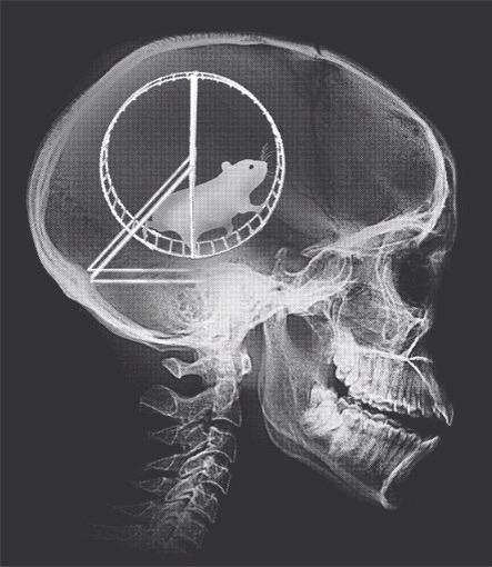 HangOn_Sloopy's tweet photo. RT "@buckeyefansonly: #OhioState Wexner Medical Center released X-ray of Mark May's brain. #GoBucks #BeatVaTech http://t.co/hC0lpibxPf"