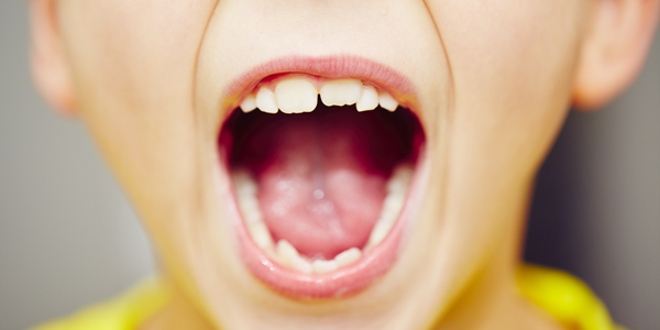 ASHAleader's tweet photo. Our new #CasePuzzler column: a child's behavior issues were caused by a #tongue-tie. http://t.co/AADCzWqEqW #SLPeeps http://t.co/kUQ6TI53uz