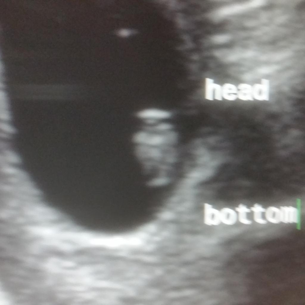 Baby C. is doing well...has a nice strong heartbeat at 174 :-) I am one proud mama already :-)