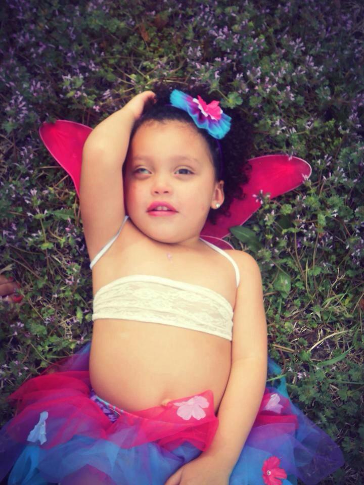 ColleyCoanna's tweet photo. @tyrabanks  her first photo shoot without her prosthetic eye  #micropthalmia #littleeye #topmodel http://t.co/xZkGeOV32e