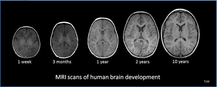 madefrombiology's tweet photo. The structure of your brain changes when you learn http://t.co/5gzjrbNdwb #biology http://t.co/ppHZahPUnV