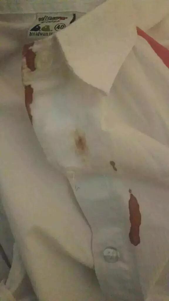 HashKsa's tweet photo. صور متداولة لـ #سقوط_مروحه_علي_طالبه بإحدى مدارس #الرياض وتشج رأسها.! http://t.co/mT9rrlMW2O