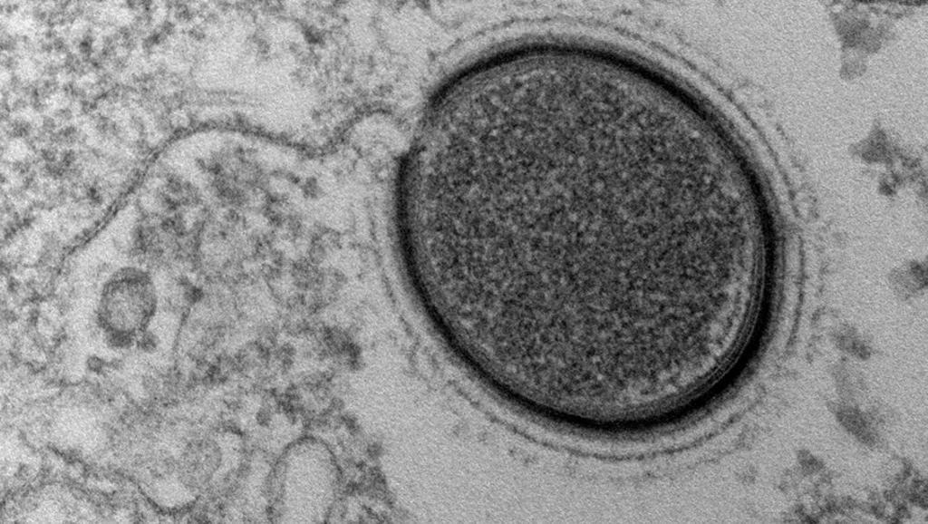 Scoperto "virus gigante" nel permafrost preistorico della Siberia.
