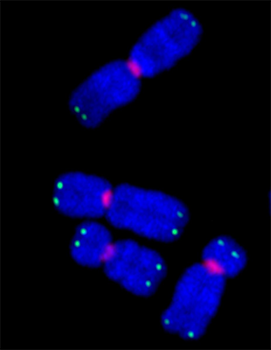 TheCesareLab's tweet photo. Loving @zeiss_micro LSM880 + Airyscan. Taken by @sonjzzz. Human chromosomes with telomere + centromere FISH http://t.co/8RnTWbdLuT