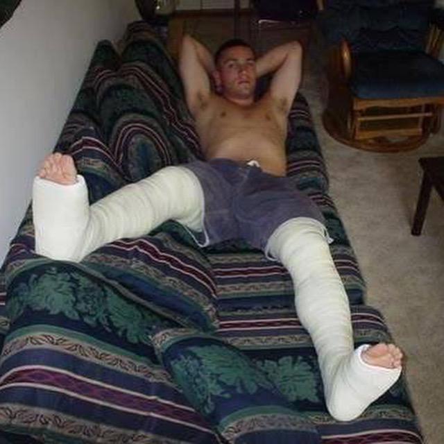 Toesnacast's tweet photo. #castboy #castedtoes http://t.co/AvWqbwIN3A