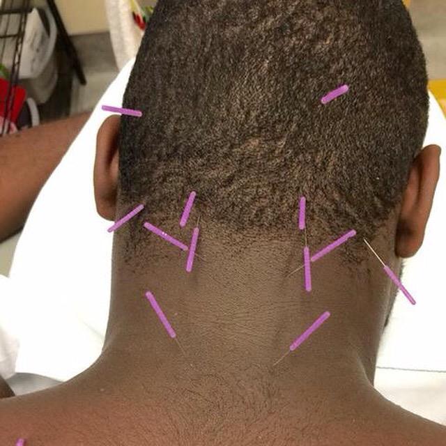 KFelderDPT's tweet photo. A day in the life of a SPT on rotation. Practicing and experiencing new modalities! #DryNeedling #SupervisedPractice http://t.co/tqoqQgjeZy
