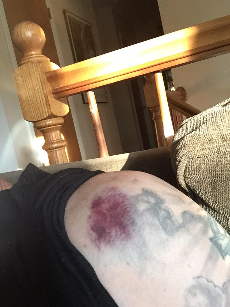 Chris Bracken tweet media