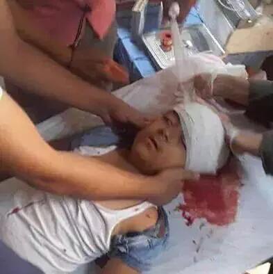 dreameryazar's tweet photo. Son dk!
10 yaşındaki Selman Ağar, sokakta AKP'nin keskin nişancıları tarafından kafasından vuruldu
 #CizreUnderAttack http://t.co/amEONgFNgG