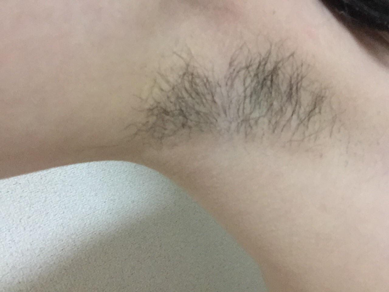 毛深い女子中学生 / X