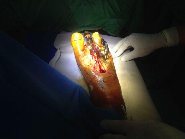Syarif_udinn's tweet photo. #diabetesmelitus http://t.co/G8jPd6K251