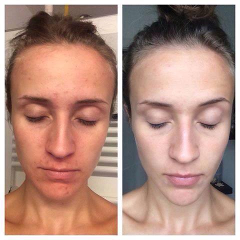 GoodbyeToBotox's tweet photo. If you need help from the inside to improve your skin just contact me http://t.co/meyqpcyJp9