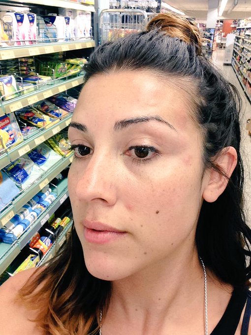 I have the kind of face only a colony of Mosquitos could love. 😟 http://t.co/KM3WU5jD7Y<a href="/tag/ootd"class="tags"><span>#ootd</span></a><a href="/tag/stockholm"class="tags"><span>#stockholm</span></a><a href="/tag/fbloggers"class="tags"><span>#fbloggers</span></a>