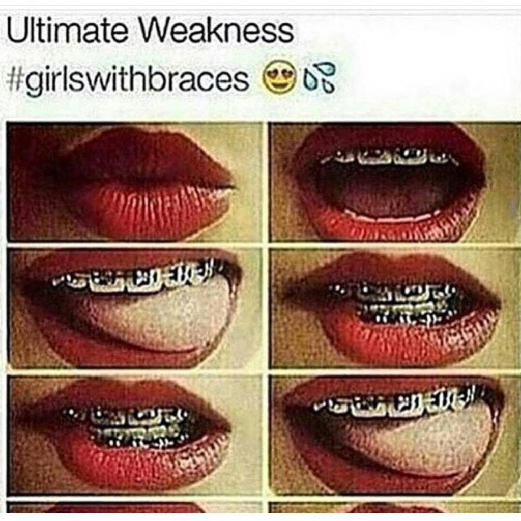 Ms. Jackson 👑 on Twitter "When you have braces but nobody checking for