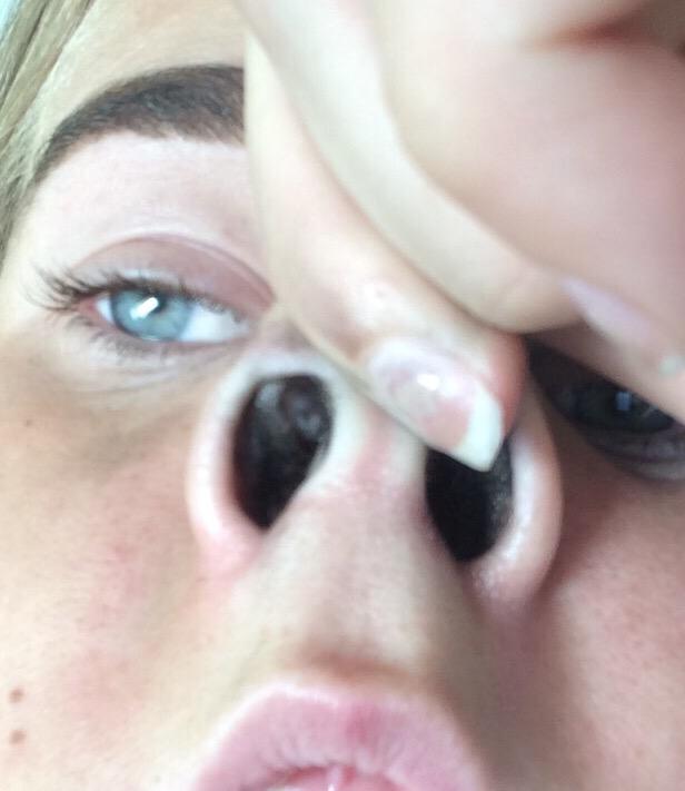 Sofnaði með kerti inni hjá mer, Reykskynjarinn fór í gang, vaknaði með reykeitrun, sót og kanye west í nefinu