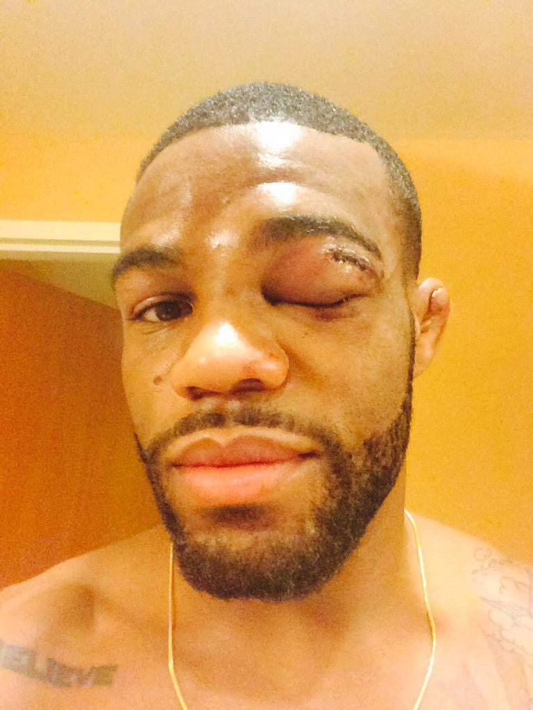 Jordan Burroughs tweet media