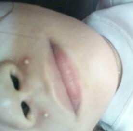 MerlynAnderson's tweet photo. #pimple de gatas  hahahahah.. 
 
 . #may_ma_ipost_lang :p http://t.co/o0RhGY9Sph