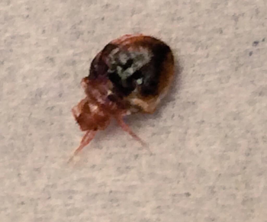 SoraBullys's tweet image. BEDBUG-FINGERNAIL&amp;amp;nasty room at @ClarionBatavia !Hotel owner IS NOT HELPFUL!@TripAdvisor