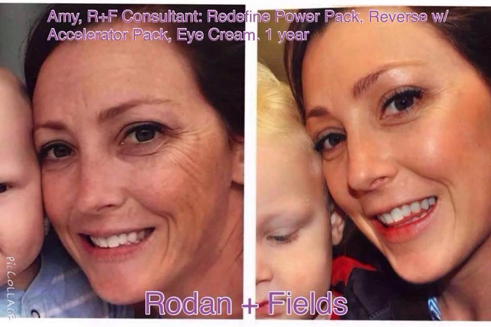 Klhiggins1's tweet photo. Want to #reclaim your skin and get back your #confidence? I can help just as me how!! http://t.co/QpTF15ezcR