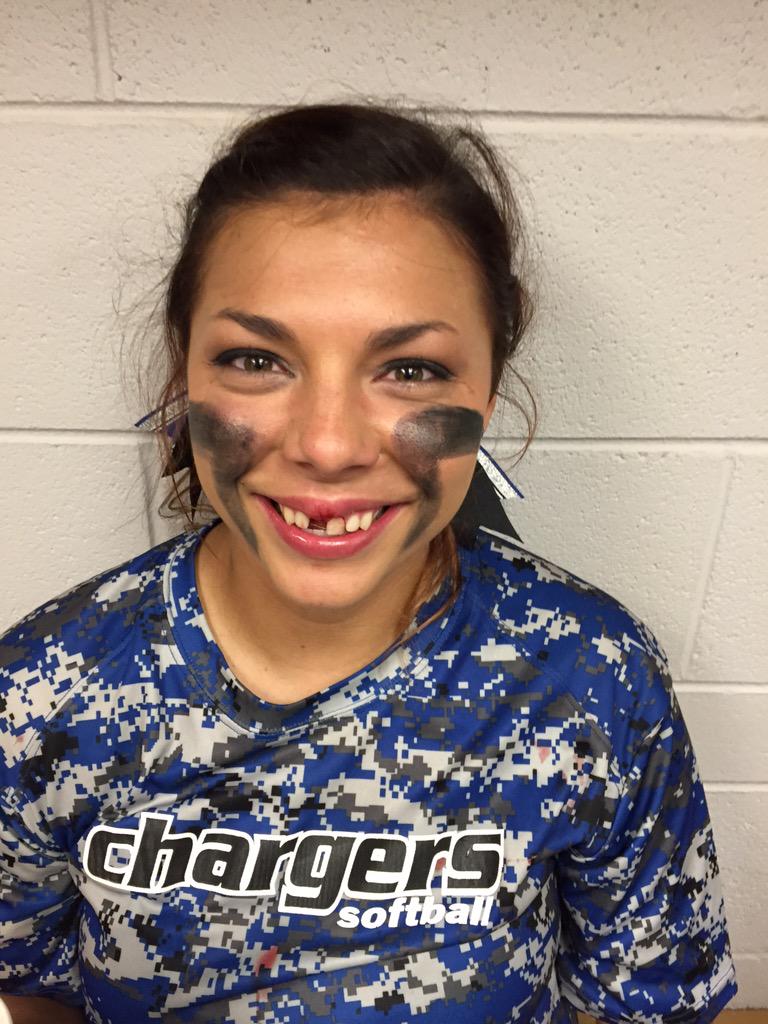 UAHCoachLes's tweet photo. Some gave all, @EmilyGlover90 gave her tooth! Coming for you @uahhockey #straightouttascottsboro http://t.co/5d524oorm0