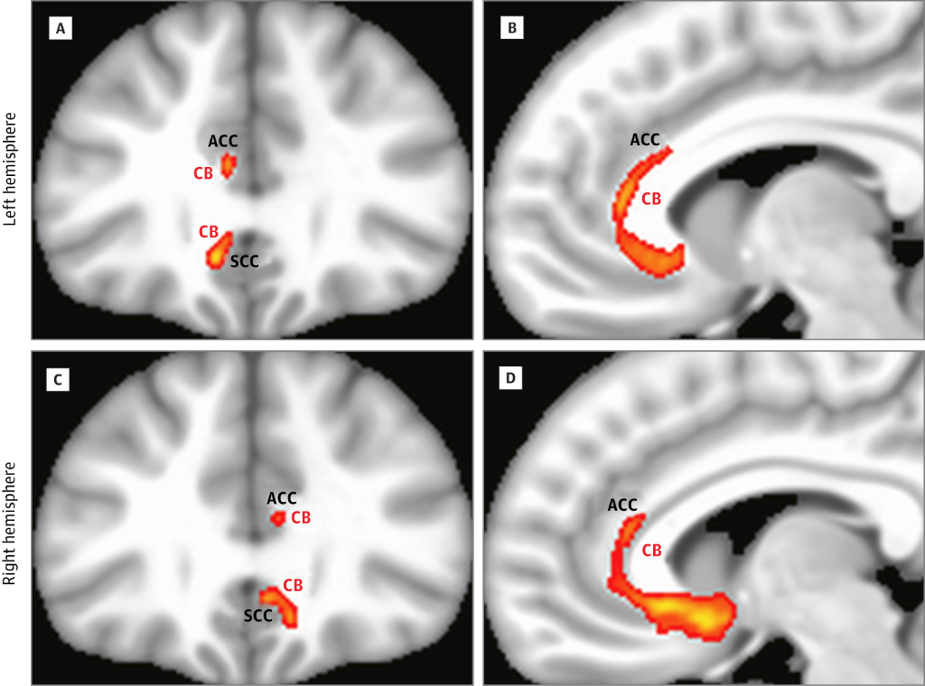 JAMANeuro's tweet photo. Mapping the “depression switch” http://t.co/Oa3eOoxFFT #ANAmtg2015 http://t.co/YhN6tphVs8