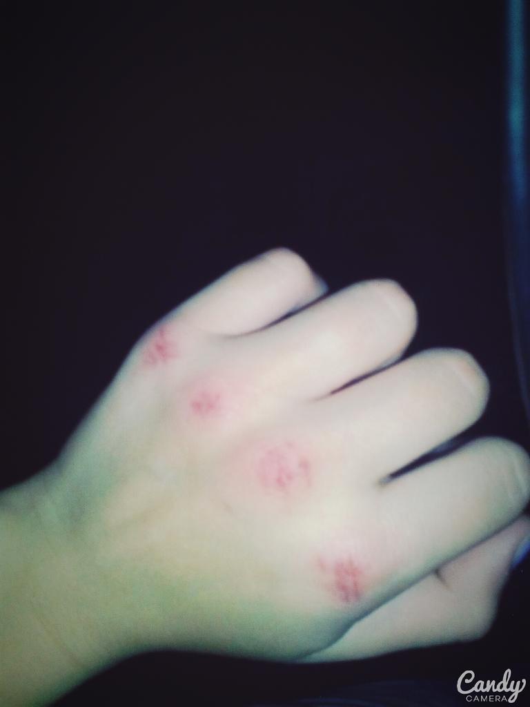 suicidedushevn3's tweet photo. Девочки с разбитыми кулаками,уже считается за норму http://t.co/3RZCpBK7cj