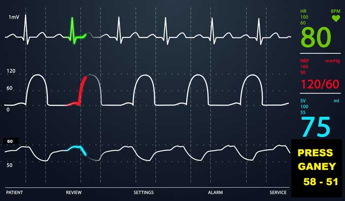 Brand New Vital Sign Added to Monitors and Electronic Medical Records gomerblog.com/2015/09/monito… #hcsm #FOAMed