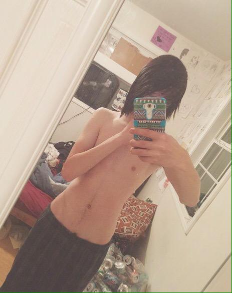 _plz_kill's tweet image. I'm so ugly like for real rt if u think I'm not