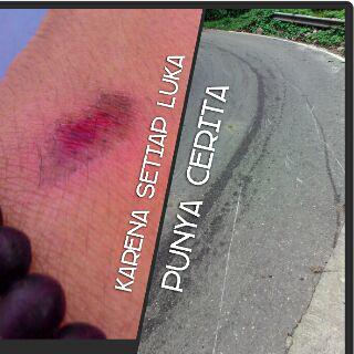 Setiap luka, punya cerita..