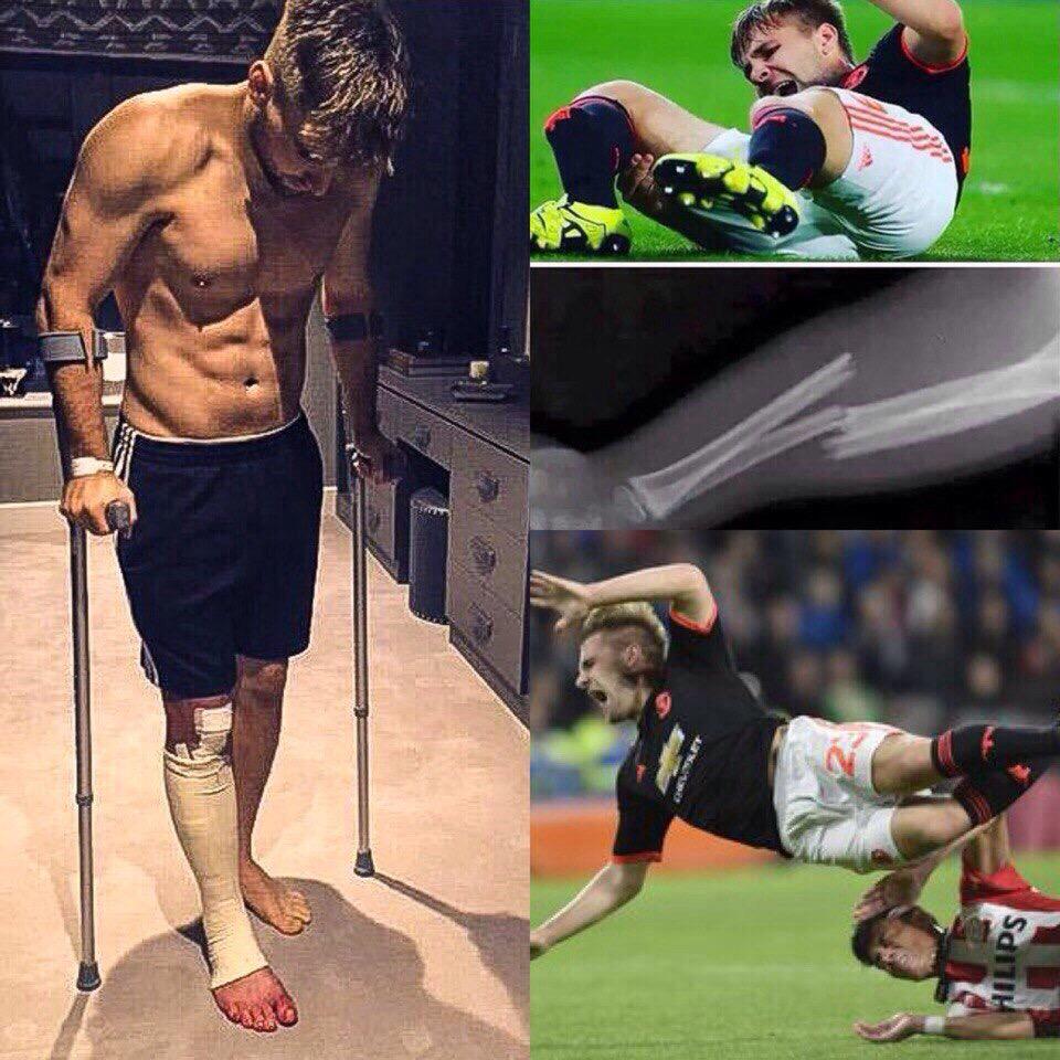 Самые страшные травмы в хоккее. Дмитрий баринов локомотив травма. Какая травма была у хромых. Какая травма была у хромых. Джон таварес торонто.