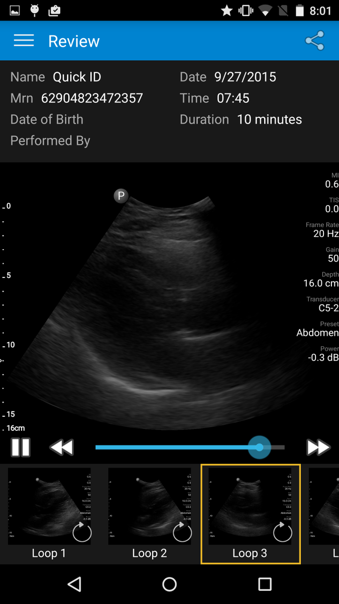 EricTopol's tweet photo. Echocardiogram of my heart thru my smartphone.....eureka! http://t.co/UvrvEX2UQX