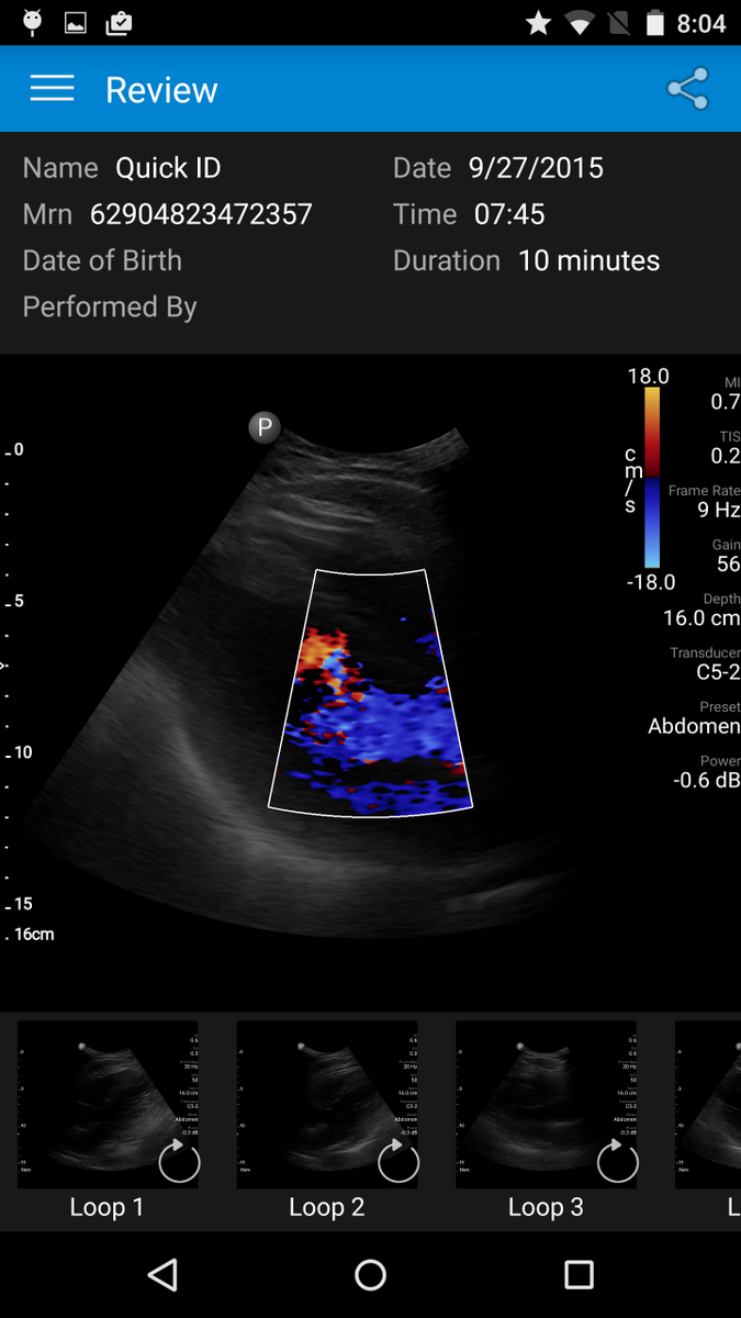 EricTopol's tweet photo. Echocardiogram of my heart thru my smartphone.....eureka! http://t.co/UvrvEX2UQX
