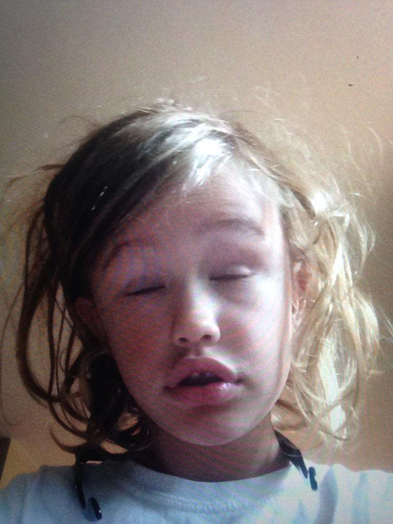 When people ask why there's a player in a different color jersey than the rest