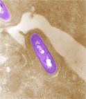 Learn about  #Listeria #Testing &amp; #Scientific #Research  &amp; how ContractLaboratory.com helps blog.contractlaboratory.com/index.php/cate…