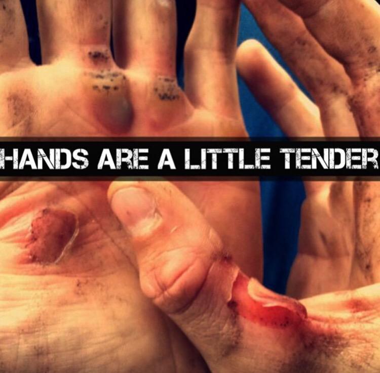 FastEddyRacesUK's tweet photo. @JonnyWalker_22 hands feeling a little tender after last years Hawkstone Park Fast Eddy! http://t.co/zSMWeh29Hi