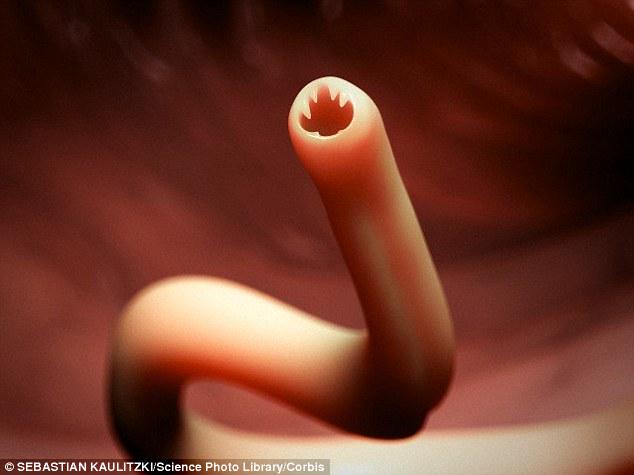 Nash_Newcast's tweet photo. #WHO 1.5 billion people #Globally were affected by parasitic worms (Helminths) as of 2015. #Crisis http://t.co/c1PCuiSb91