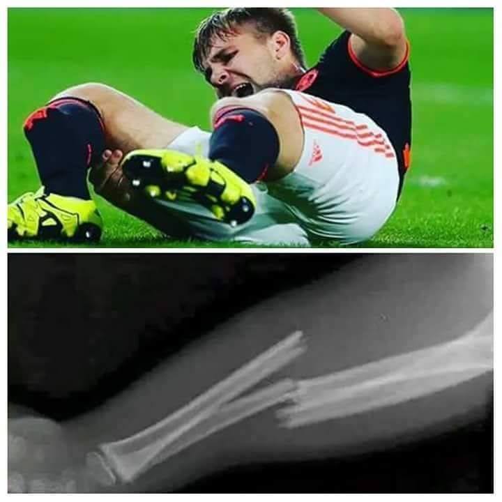 ManutdMagazine's tweet photo. Sedih lihat #ManUtd kalah.
Tapi lebih sedih lagi lihat Luke Shaw kakinya patah.
#GWS_Shaw http://t.co/xM1a6oeQBq