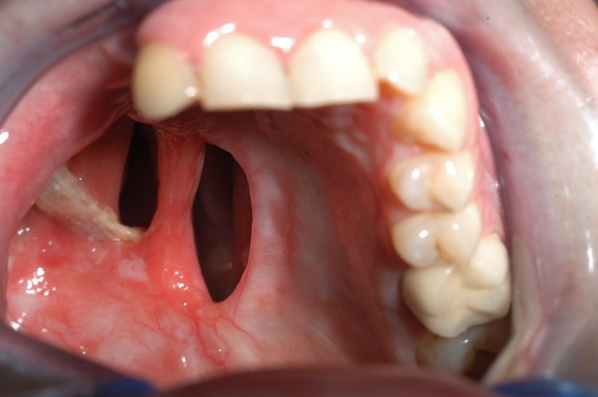 EttoreMarini's tweet photo. #Cocaine abuse is now the fastest-growing #drug #problem among the middle classes. #change #stop #quit #mouth #teeth http://t.co/zFhyeKBcyx