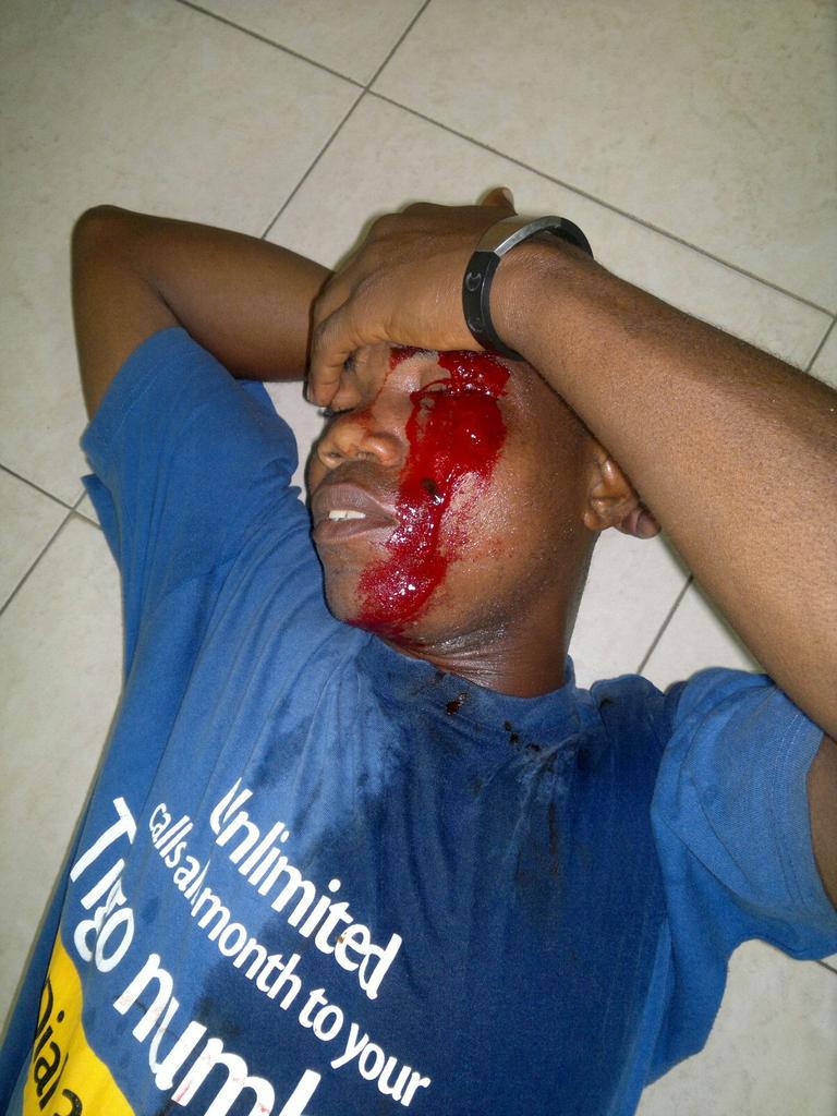 Kojokaba's tweet photo. March for a new voter register turn bloody. http://t.co/JZmiokTcND