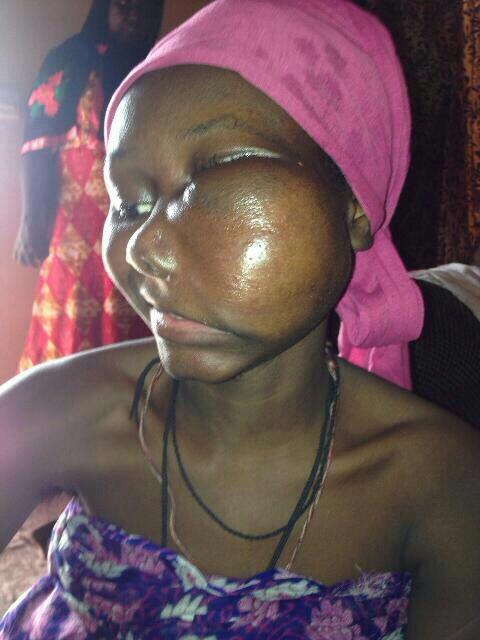 jalloous1's tweet photo. Please help! 18th old girl needs urgent supports for cancer treatment.
http://t.co/cpKNggCrCY thanks http://t.co/nVU8aYROmM